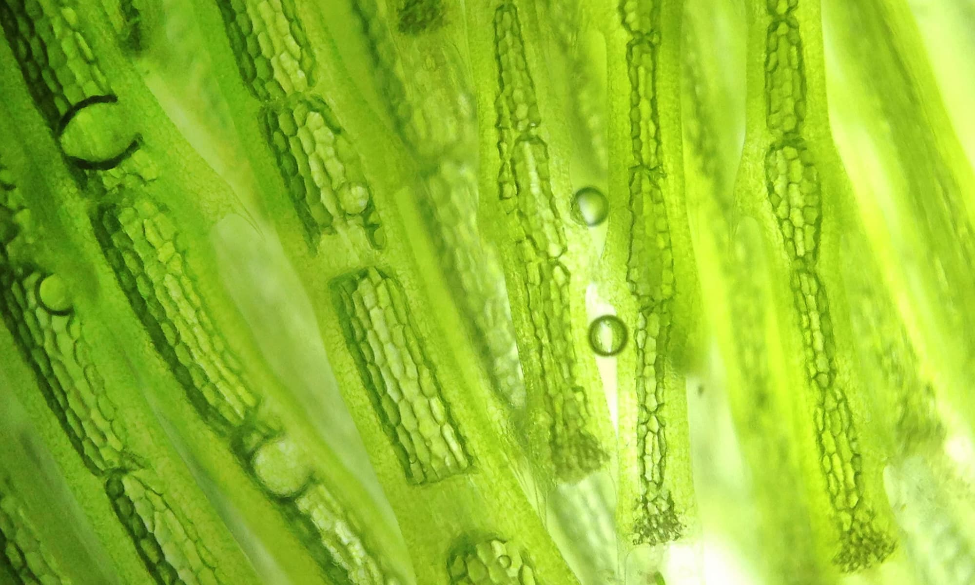 Mikroskopische Aufnahme von grünen Pflanzenzellen mit Chloroplasten